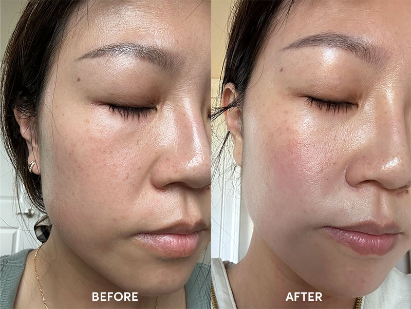 b.glen C serum before and after