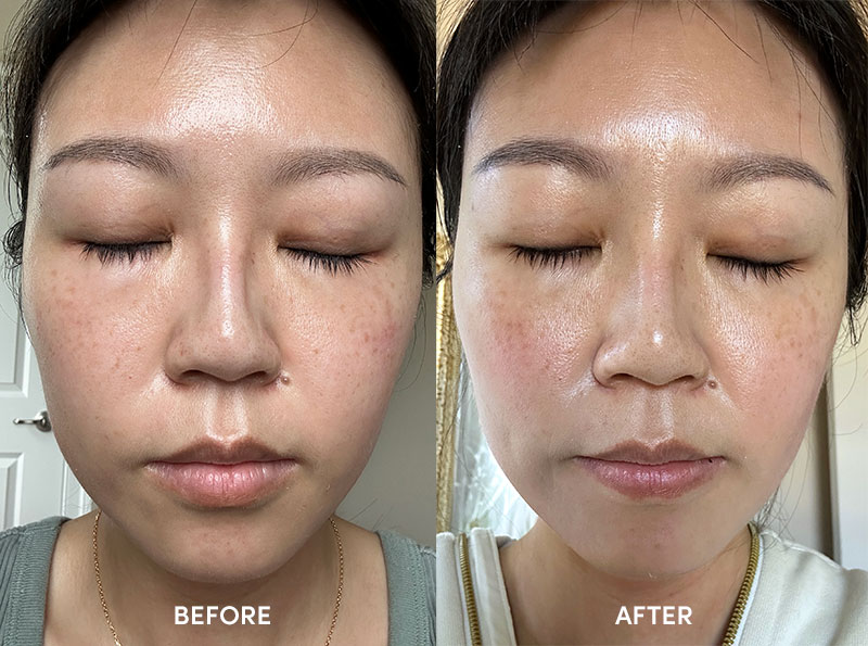 b.glen C serum before and after