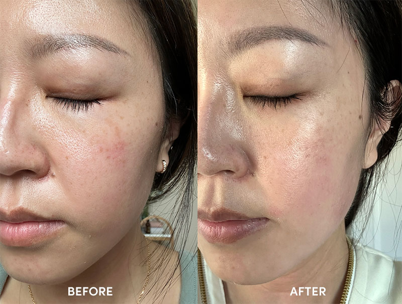 b.glen C serum before and after